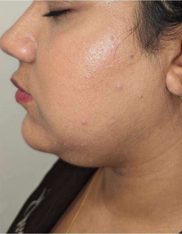 vitamin c for lips as seen on tv Amazon.com : Brightening Lip Balm with SPF 30 | For Dark, Pigmented, Dry,  Flaky Lips | Brightens Pigmented Lips | Vitamin C | SPF 30 for Sun Damage  and Discoloration